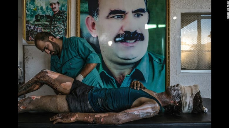 شاهد.. الأعمال التي حازت على جائزة "أفضل صور الصحافة 2016" شاهد.. الأعمال التي حازت على جائزة "أفضل صور الصحافة 2016"