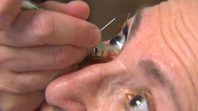 بالفيديو: حقنة قاسية "في بؤبؤ العين" قد تكون الوسيلة الوحيدة لمواجهة فقدان البصر