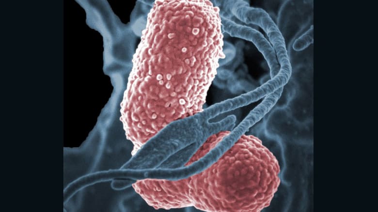 تعر فوا إلى أشد أنواع البكتيريا المقاومة للمضادات الحيوية Cnn Arabic