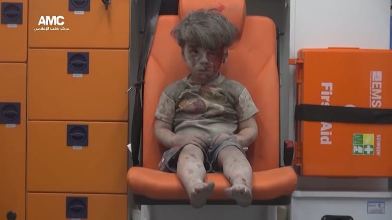 طفل يختصر بوجهه مأساة حلب يُنتشل من ركام قصف قوات النظام