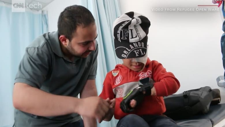 من لاجئ سوري مبتور الساق إلى فني طباعة أطراف صناعية