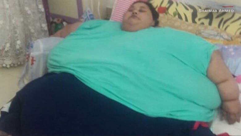 بسمة إيمان تعود.. أثقل امرأة في العالم تفقد 100 كيلوغرام من وزنها