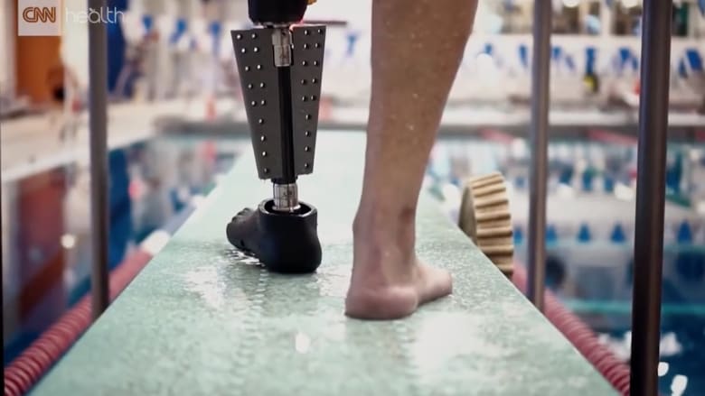 أطراف اصطناعية تمكّن مبتوري الساق من السباحة