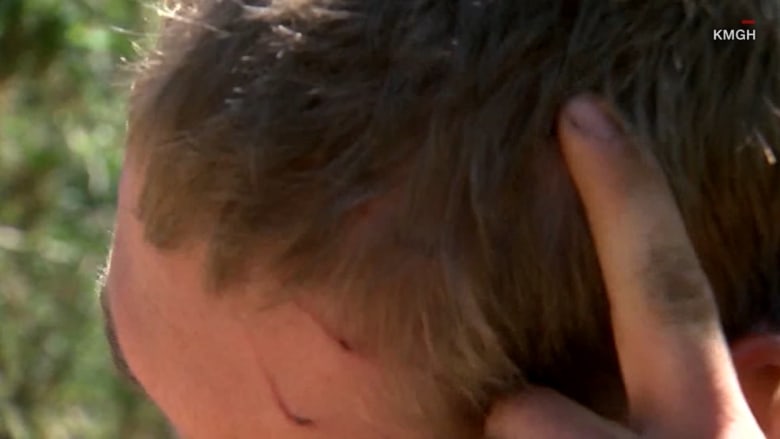 بالفيديو: دب يهاجم شاباً ويعض رأسه أثناء نومه بمخيّم سياحي