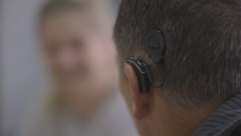 أبل تشارك في صناعة قوقعة اصطناعية لمساعدة ضعاف السمع