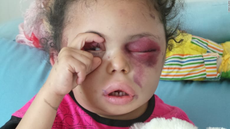 بثينة تفتح عيون العالم على الصراع اليمني
