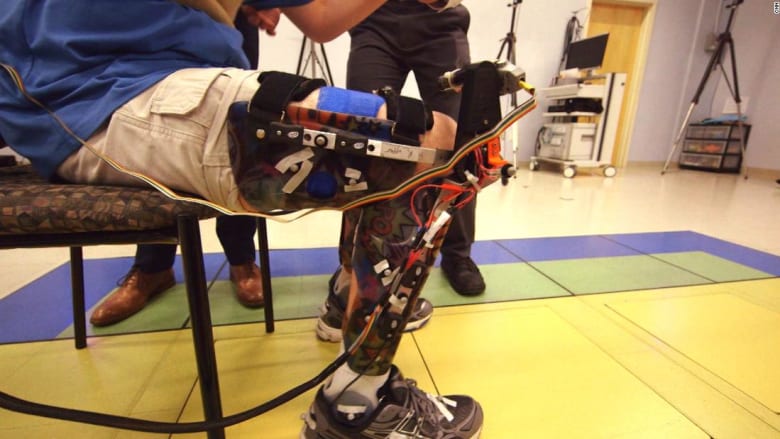 روبوت لمساعدة الأطفال المصابين بالشلل الدماغي على المشي