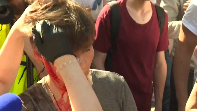 إصابات في اشتباكات بين محتجين والشرطة في موسكو