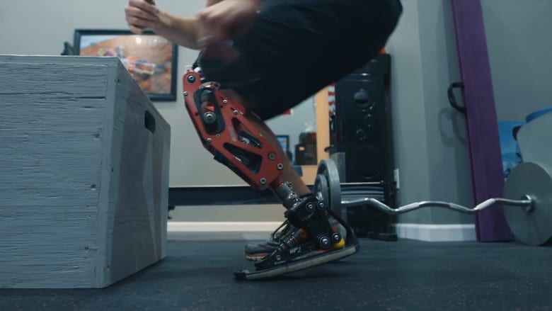 رياضي يصنع ساقا اصطناعية لنفسه ويفوز بها بميداليات ذهبية