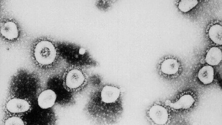 ما الفرق بين فيروس كورونا والفيروسات الأخرى؟