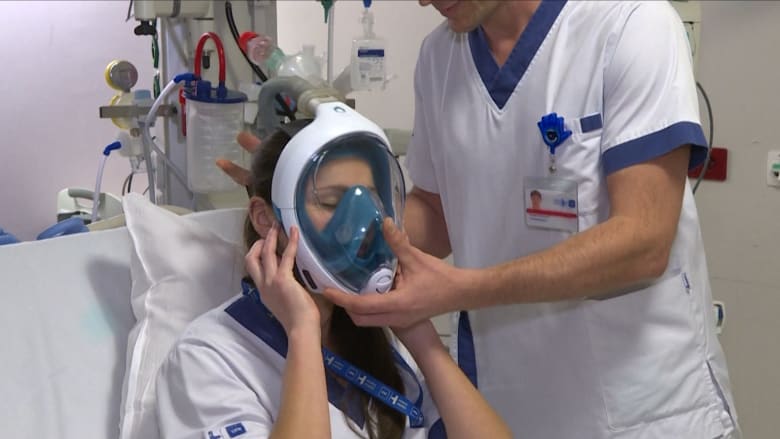 مستشفى بلجيكي يحول أقنعة الغطس إلى أجهزة التنفس الصناعي لمكافحة فيروس كورونا