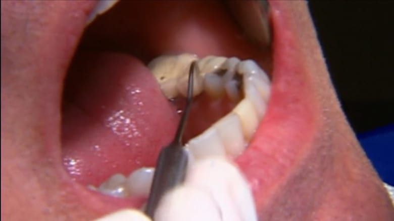 طريقة الوصول إلى طبيب الأسنان خلال جائحة فيروس كورونا