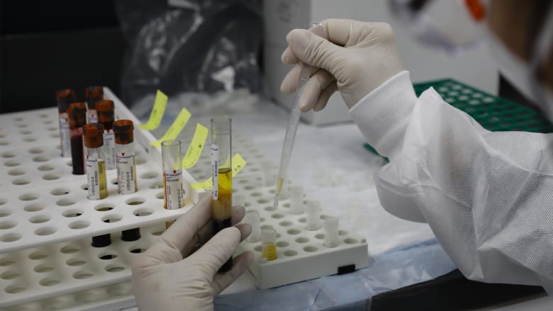 https arabic cnn com health article 2020 11 26 sleep study us uk netherlands wellness