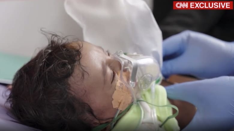 تحقيق حصري لـCNN.. المجاعة تضرب اليمن وسط صراع السعودية والحوثيين