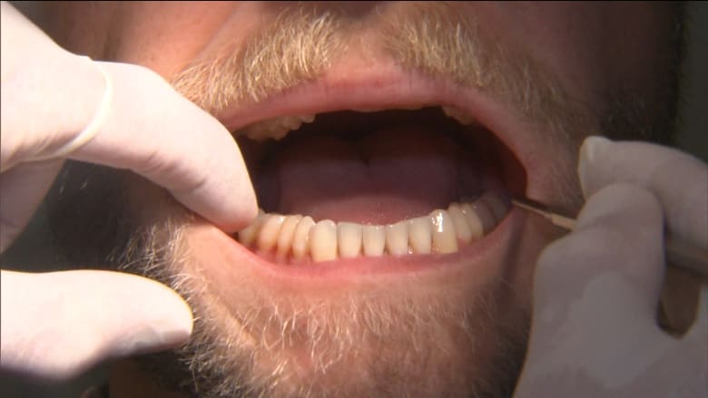 يمكن أن يؤدي إلى فقدان الأسنان وألم في الفك.. إليك بعض الطرق لمنع صرير أسنانك
