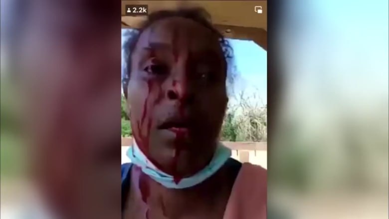 بالفيديو.. امرأة سودانية تشتكي تعرضها للضرب على يد الجيش