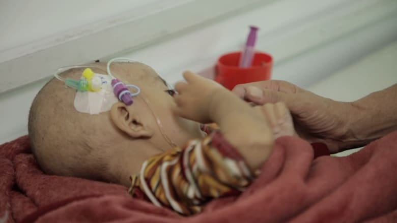 سوء تغذية ونظام رعاية صحية منهك.. شاهد ما يعانيه الأفغان في هرات