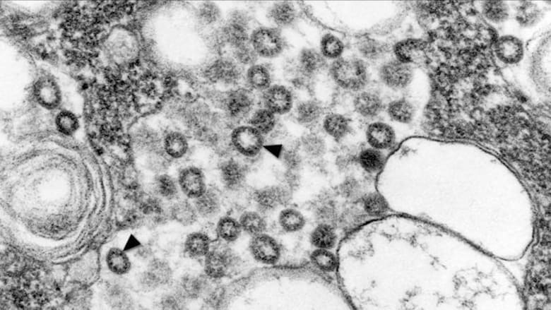 دراسة جديدة حول "فيروس كورونا طويل الأمد" توصّلت إلى نتائج غير سارّة.. ما هي؟