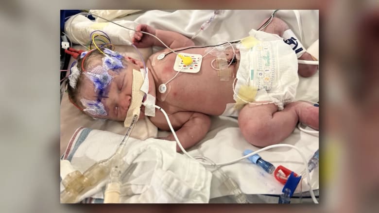 16 دقيقة بلا نبض وأكسجين.. شاهد كيف نجا طفل في اللحظات الأولى من ولادته