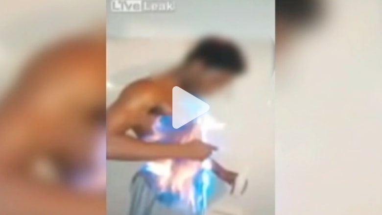 شاب يحرق نفسه بمساعدة والدته لكسب صداقات جديدة بفيسبوك شاب يحرق نفسه بمساعدة والدته لكسب صداقات جديدة بفيسبوك