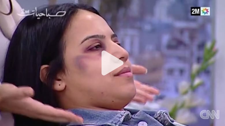 تعليم التبرج لـ"تغطية" العنف المنزلي يغضب المغاربة تعليم التبرج لـ"تغطية" العنف المنزلي يغضب المغاربة