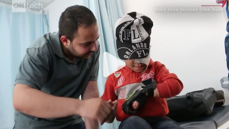 من لاجئ سوري مبتور الساق إلى فني طباعة أطراف صناعية من لاجئ سوري مبتور الساق إلى فني طباعة أطراف صناعية