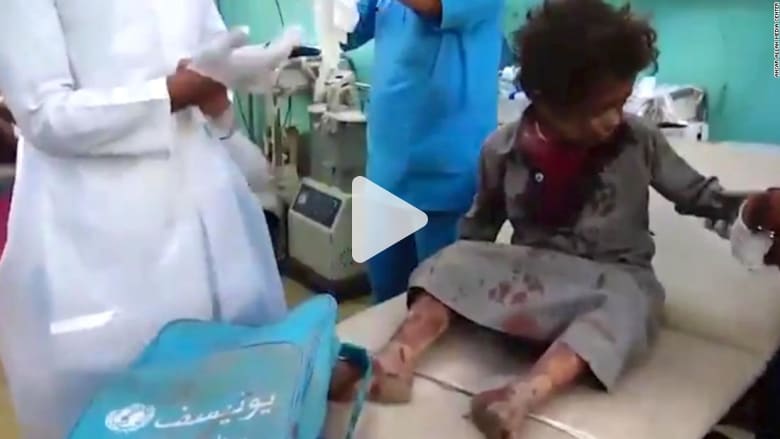 مقتل عشرات الأطفال في غارة على حافلة مدرسية باليمن مقتل عشرات الأطفال في غارة على حافلة مدرسية باليمن