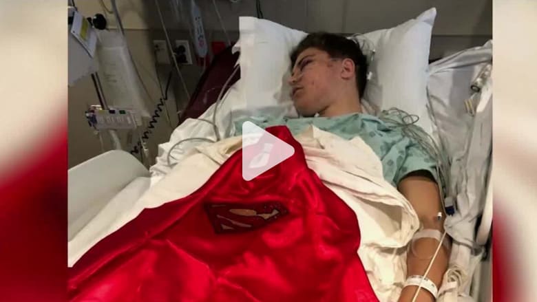 نهاية صادمة لمحاولة التقاط صورة سيلفي أعلى جسر في دالاس نهاية صادمة لمحاولة التقاط صورة سيلفي أعلى جسر في دالاس