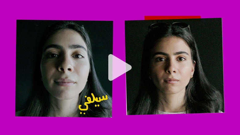 سؤال.. ما هو السبب وراء صور "السيلفي" البشعة؟ سؤال.. ما هو السبب وراء صور "السيلفي" البشعة؟