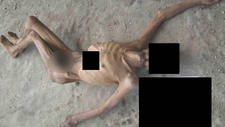 صورة تظهر بقايا رجل هزيل يزعم أنه قتل في السجون السورية