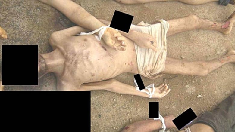 جثة رجل يزعم أنه قتل في السجون السورية تظهر عليها آثار جراح في اليدين والقدمين.