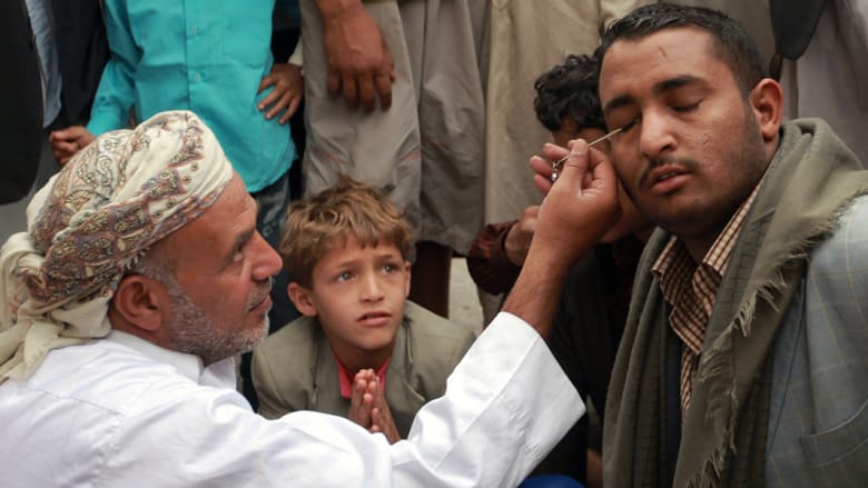 رجل يضع الكحل على عينيه لكونها من التقاليد المحلية في رمضان باليمن.