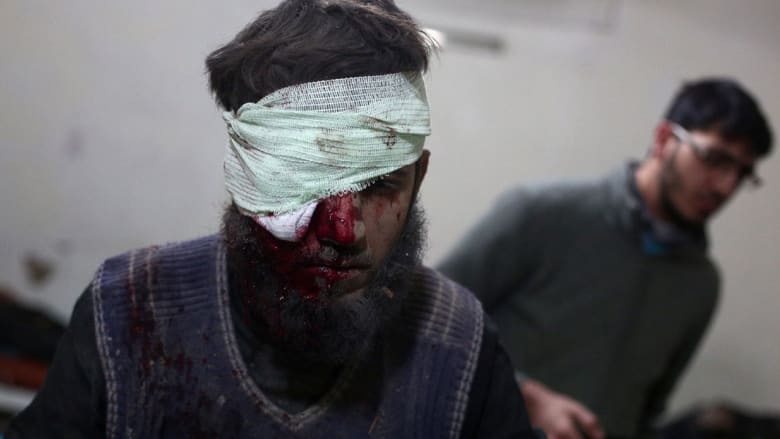 شاهد بالصور.. عشرات القتلى ودمار واسع بدوما قرب دمشق بعد ساعات على نفي الأسد استخدام براميل متفجرة