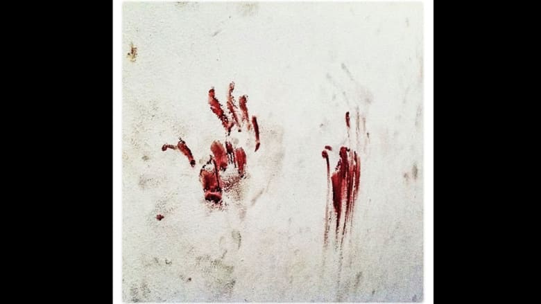 من دماء القتلى إلى جثة القذافي.. مصور أمريكي عاش الموت والحياة بليبيا يخلّد بعدسته أبرز لحظات الثورة