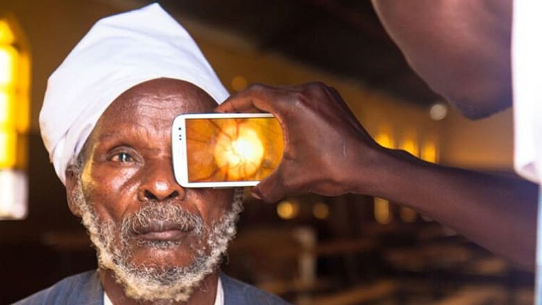 حين تخدم التكنولوجيا الإنسانية.. تطبيق هاتف ذكي يعالج حالات العمى في البلدان الفقيرة