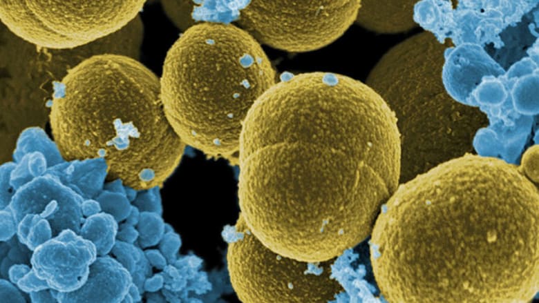 تعرّفوا إلى أشد أنواع البكتيريا المقاومة للمضادات الحيوية 