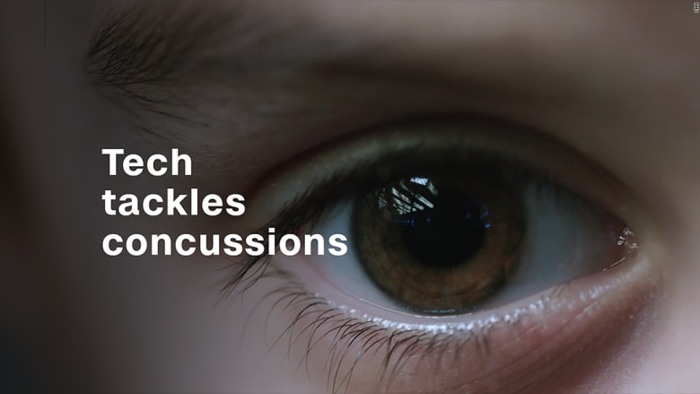 كيف يمكن تشخيص ارتجاج من حركة العينين؟