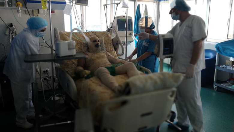 لبنان: لاجئ سوري يحاول الانتحار حرقا.. والمرعبي ينتقد "البخل المخزي" للمجتمع الدولي