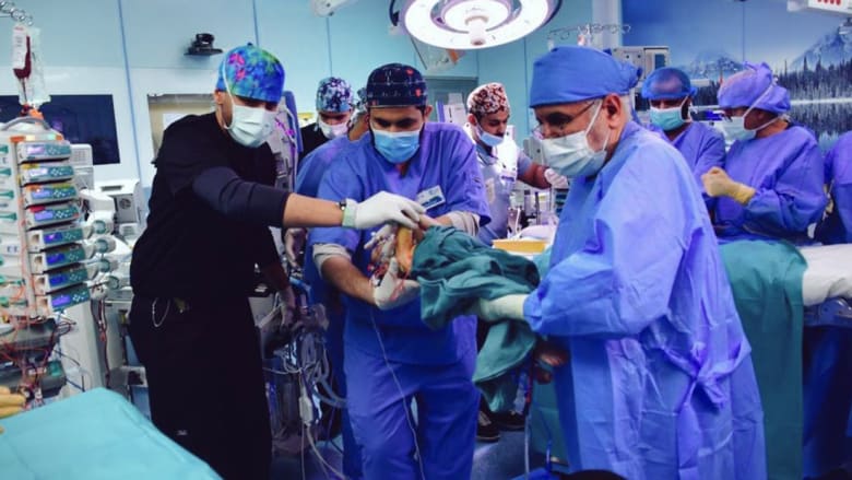 من عملية فصل التوأم السيامي العراقي 