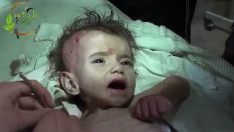 بعد البراميل.. الجوع يفتك بالأطفال في سوريا