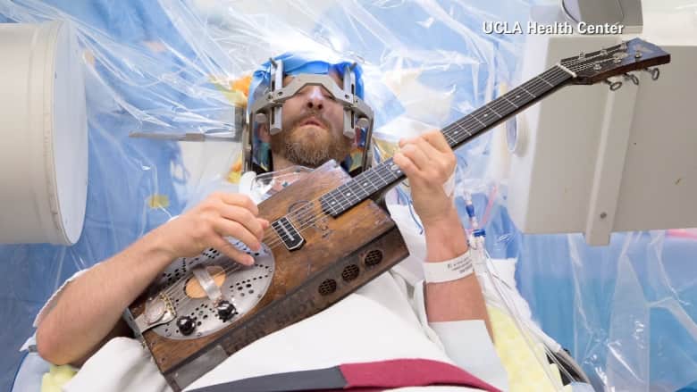 ما هي قصة الرجل الذي لعب الغيتار خلال عملية جراحية دماغية؟
