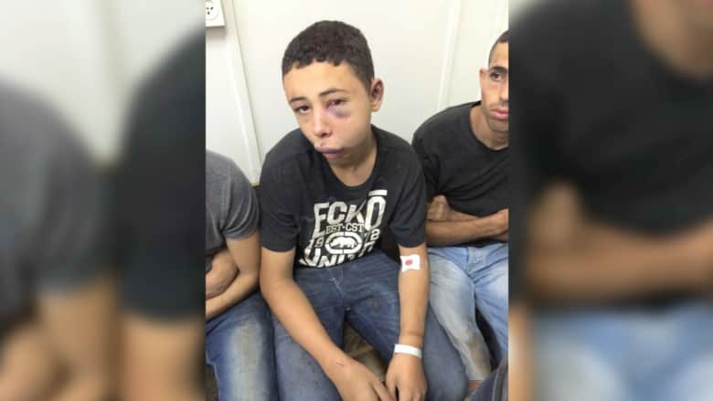عناصر أمنية إسرائيلية تعتدي بالضرب العنيف على فتى أمريكي من أصل فلسطيني