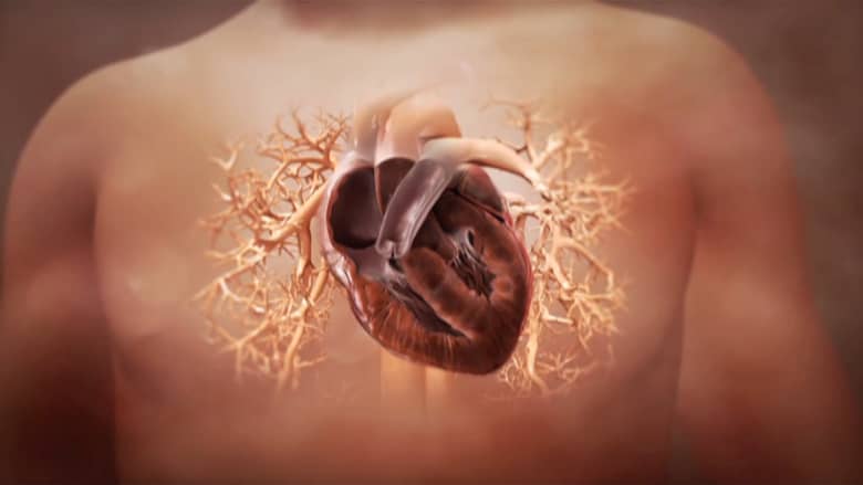 تجربة طبية قد تؤدي لعلاج أضرار النوبة القلبية بالخلايا الجذعية