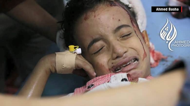 طفل يمني جريح يشغل تويتر بصرخة "لا تدفنوني"