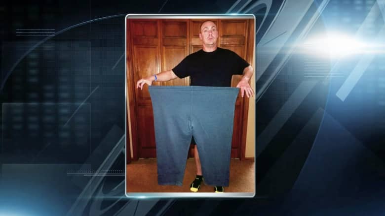 كيف خسر هذا الرجل 70 كيلوغراماً من وزنه بـ10 أشهر بعد معاناة مع السمنة؟