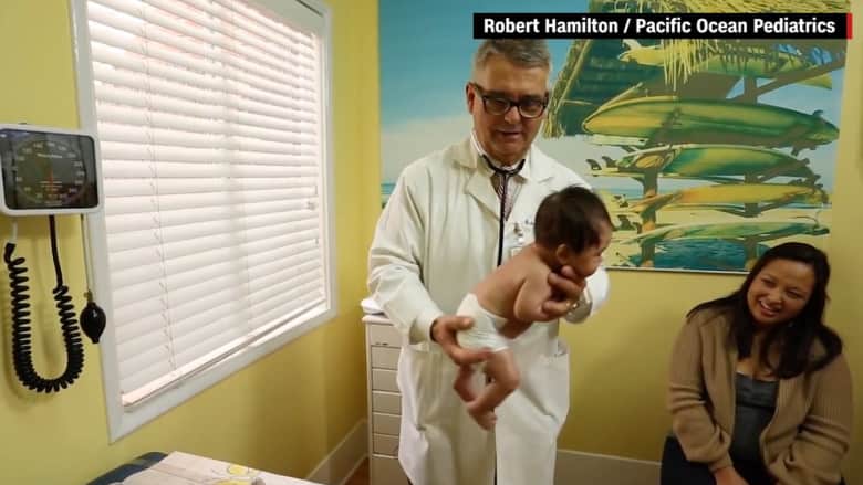 شاهد.. حيلة من طبيب أطفال لإيقاف بكاء الرُضّع تصل للملايين عبر يوتيوب