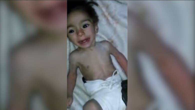 بالفيديو: أطفال بلدة مضايا السورية يموتون جوعاً