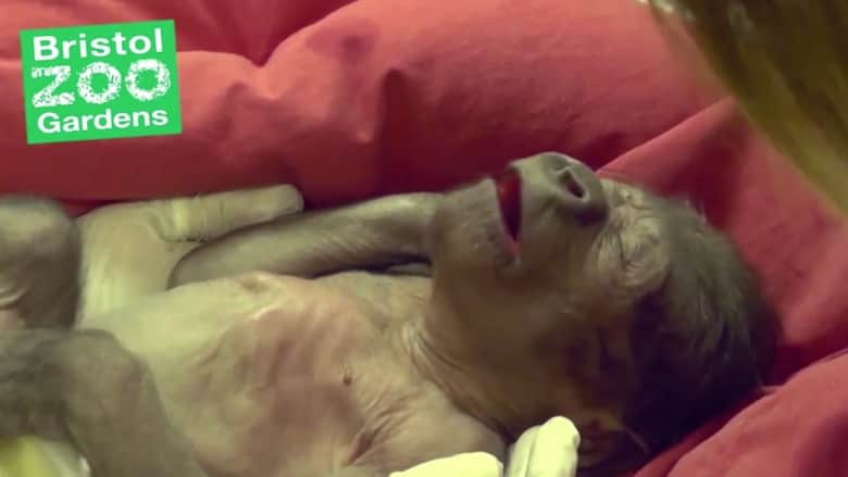 بالفيديو: أطباء بريطانيون يجرون عملية قيصرية.. لكن المولودة "غوريلا"!