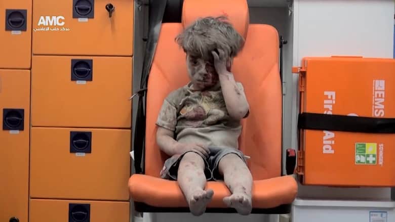 ملتقط صورة طفل حلب "عمران" لـCNN: هذا هو الوضع اليومي في حلب