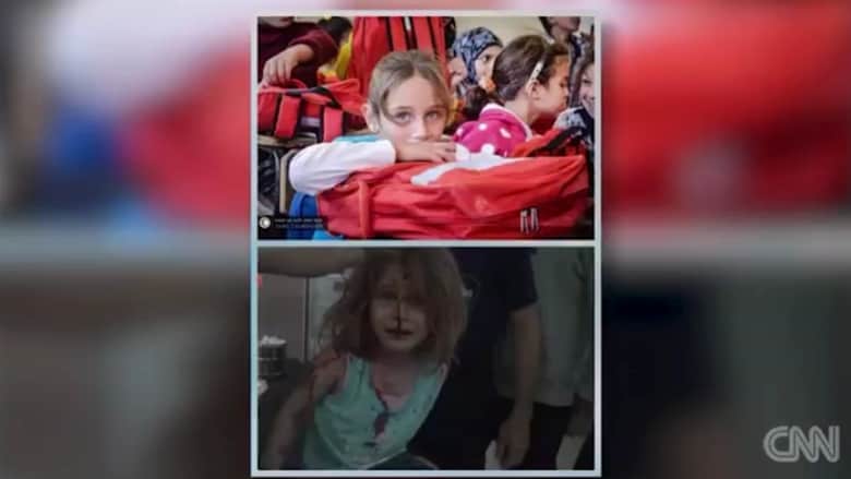 صور طفلة سورية قبل وبعد القصف تهز مشاعر العالم